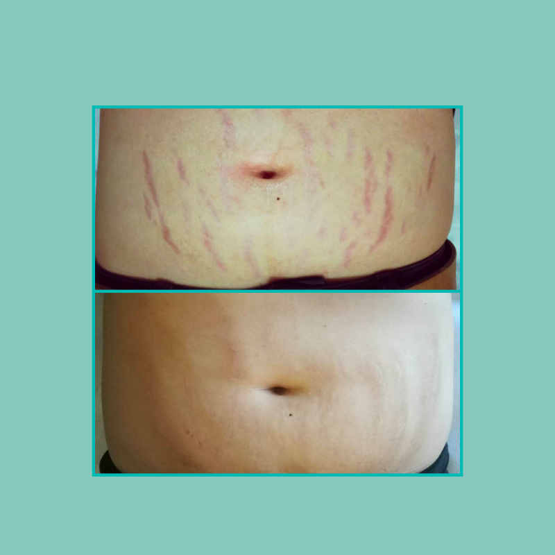 soins du corps 2 parure de magazine