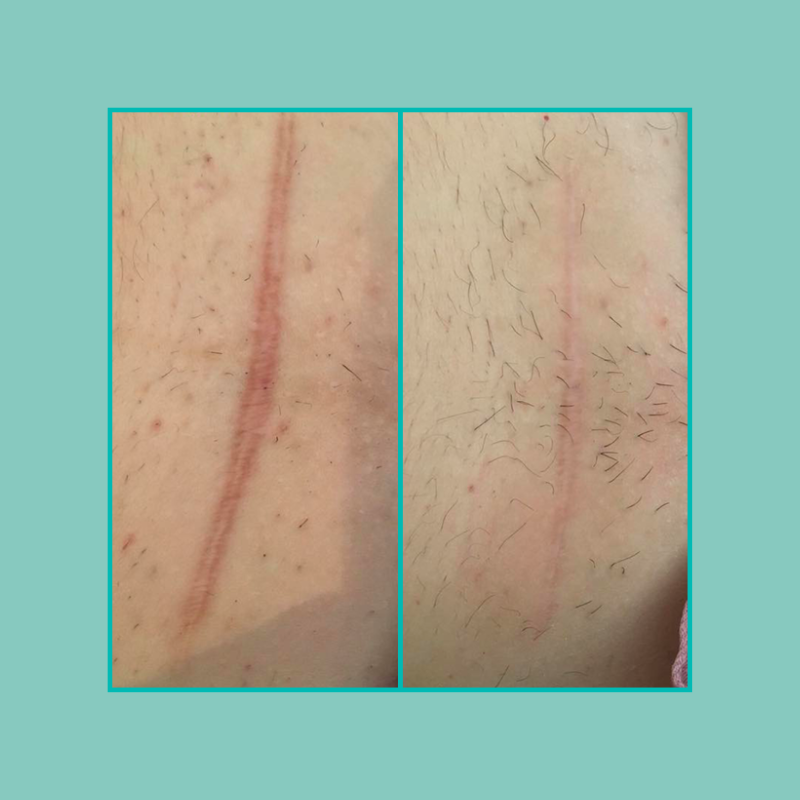 soins du corps 1 soin visage lissant