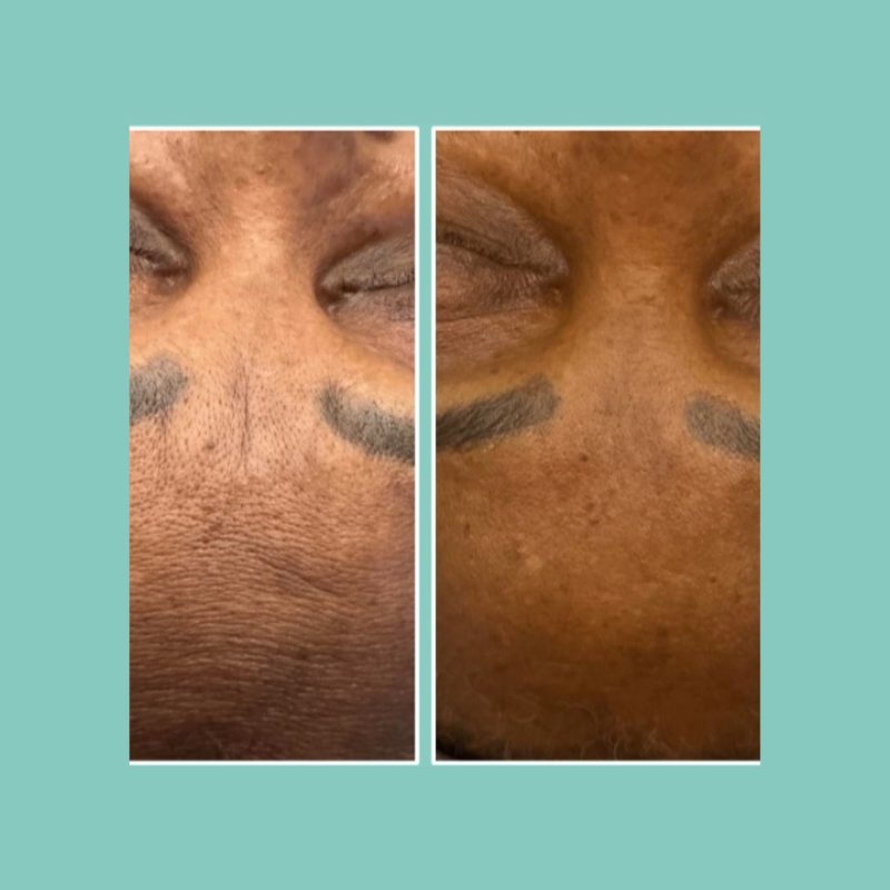 soins visage 4 Design sans titre 3 1