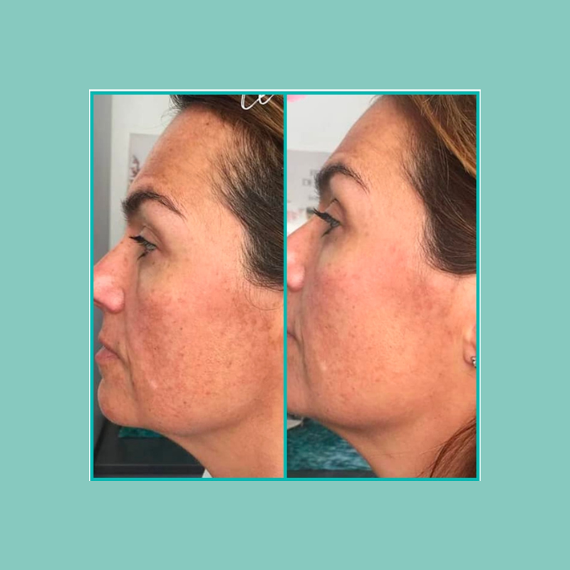 soins visage 2 parure de magazine