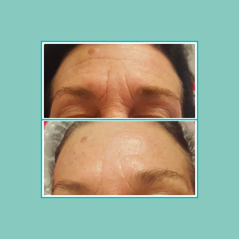 soins visage 7 parure de magazine